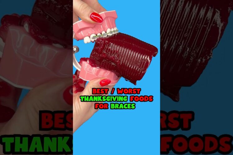 6 BEST and WORST Thanksgiving DINNER foods for braces 👀 #braces #dinner #asmrfood